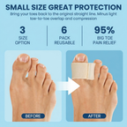 Valgus Silicon Spacers (6 Pairs)